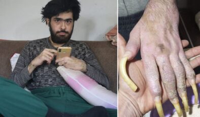 Türkiye’nin konuştuğu Barış’ın son hali! 25 yaşını kutladı, türkü bile söyledi