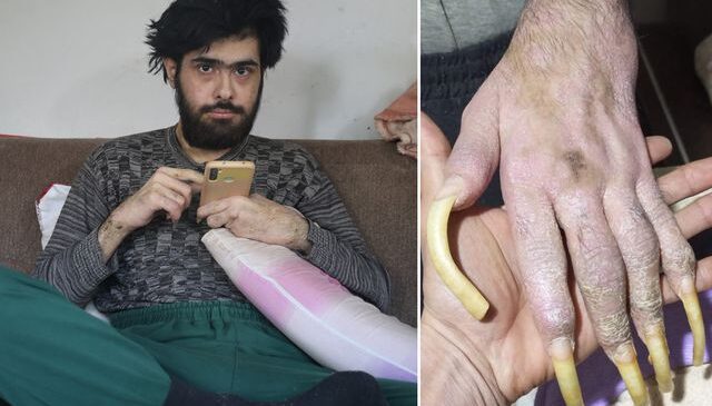 Türkiye’nin konuştuğu Barış’ın son hali! 25 yaşını kutladı, türkü bile söyledi