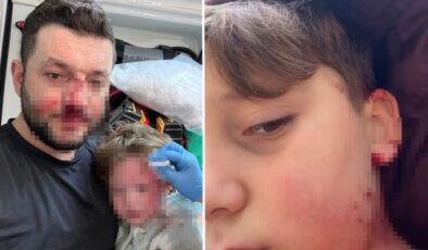 Yalova’da husumet büyüyor: Aynı ailenin 8 yaşındaki çocuğu da yaralandı