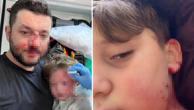 Yalova’da husumet büyüyor: Aynı ailenin 8 yaşındaki çocuğu da yaralandı