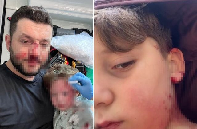 Yalova’da husumet büyüyor: Aynı ailenin 8 yaşındaki çocuğu da yaralandı