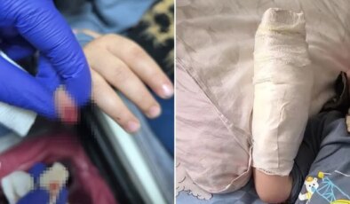 AVM’de yürüyen merdivene eli sıkışan çocuğun parmağı koptu