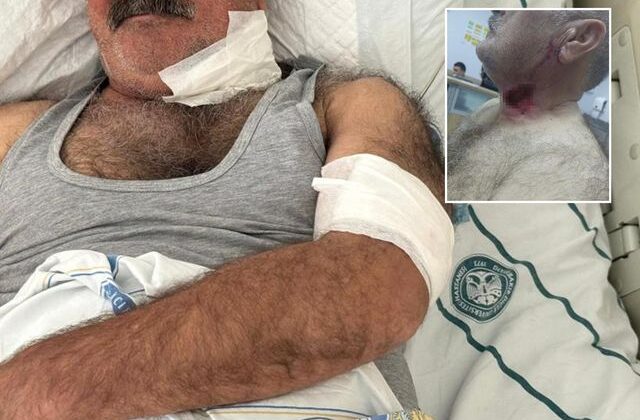 Severek beslediği hayvan bu hale getirdi