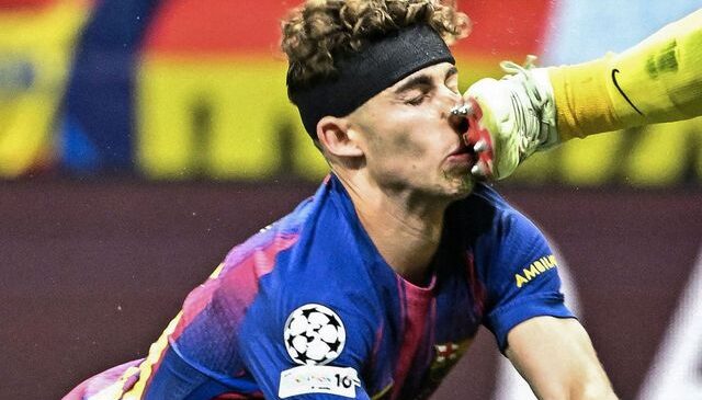 Atletico Madrid-Barcelona maçında yürekleri ağza getiren sakatlık