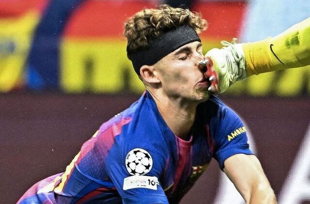 Atletico Madrid-Barcelona maçında yürekleri ağza getiren sakatlık