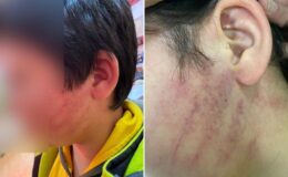 Bu kadarına da pes! Veliler okulda 8 yaşındaki çocukları dövdü