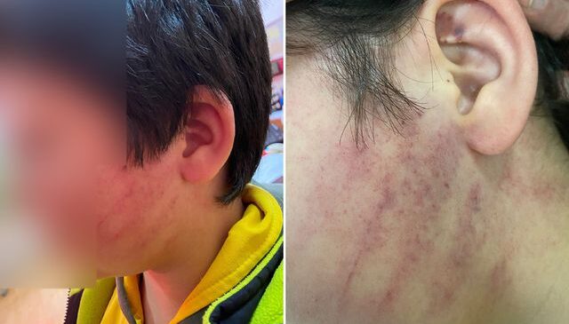 Bu kadarına da pes! Veliler okulda 8 yaşındaki çocukları dövdü