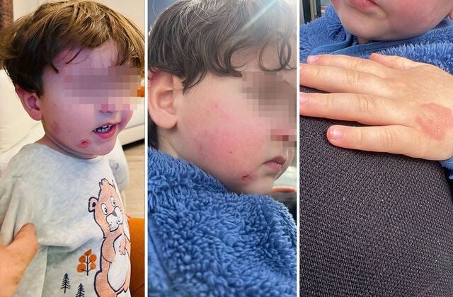 Kreşe bıraktığı çocuğunu darp edilmiş halde aldı