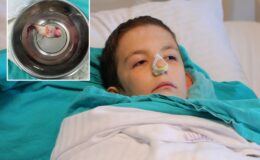 Burun tıkanıklığı şikayetiyle hastaneye gitti, ağzından dev bir polip çıkartıldı