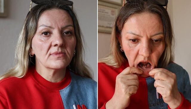 Diş ağrısı şikayetiyle gitti, 25 dişinden oldu