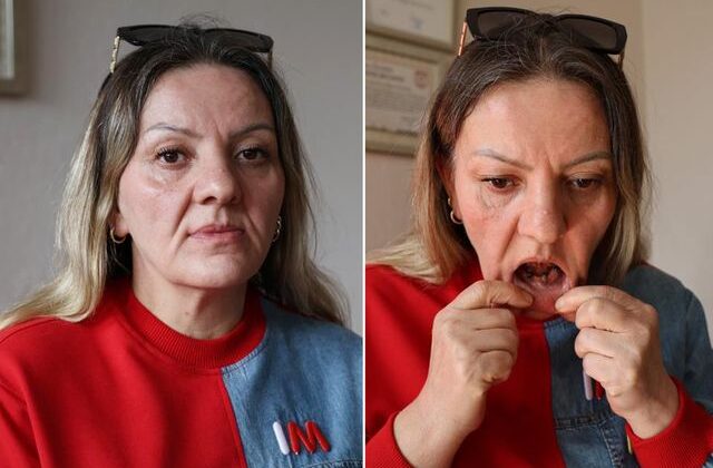 Diş ağrısı şikayetiyle gitti, 25 dişinden oldu