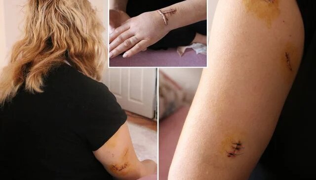 Dini nikahlı eşi 30 yerinden bıçakladı: Yarım kalan işini tamamlayacak