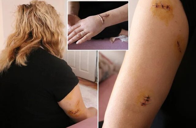 Dini nikahlı eşi 30 yerinden bıçakladı: Yarım kalan işini tamamlayacak