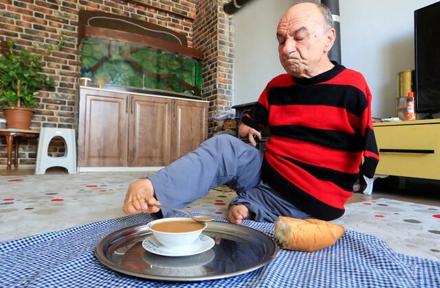 Doğduğu gün ölümüne karar verilen Mehmet Amca’nın hayat hikayesi ağlattı