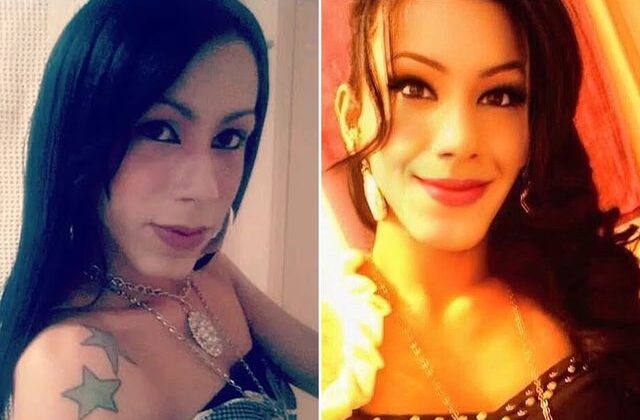 Güzellik uğruna yüzü tanınmaz hale geldi! Yine akıllanmadı