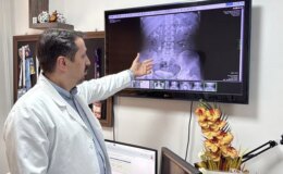 İdrar kanalından çıkan 51 taş, doktorları bile şaşkına çevirdi