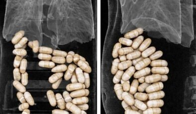 İzmir’de 2 şüphelinin midesinden 1 kilo 304 gram uyuşturucu çıktı