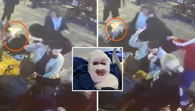 Kadıköy’de hemcinsini kolonya ile yakmıştı; mahkemede ilk sözü “pişmanım” oldu