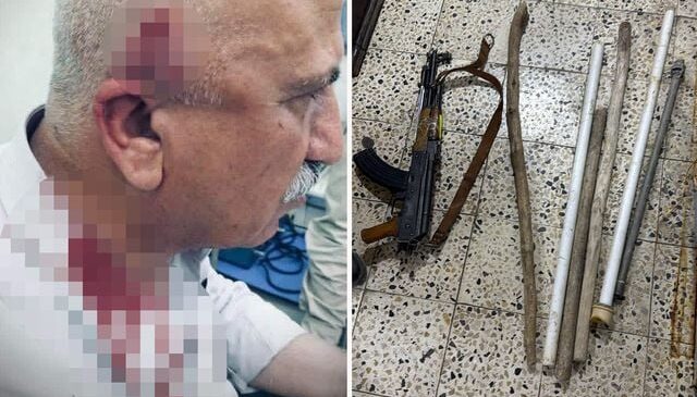 Kerkük’te kaçak yapı yıkımı sırasında kaymakama bıçaklı ve sopalı saldırı