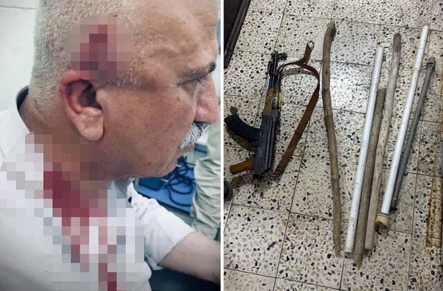 Kerkük’te kaçak yapı yıkımı sırasında kaymakama bıçaklı ve sopalı saldırı