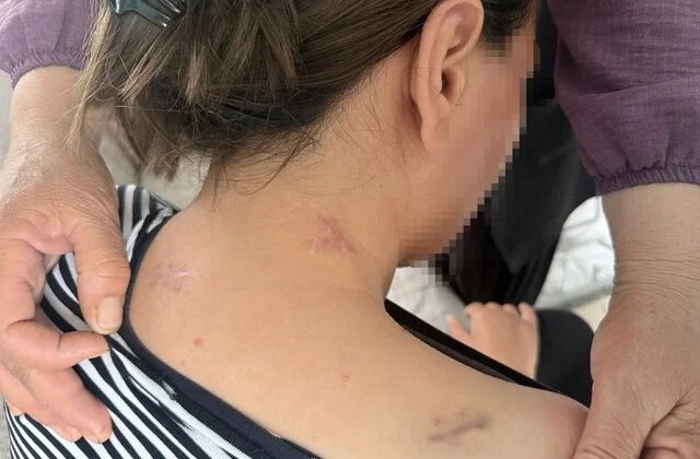 Eşinin saldırdığı kadın 17 bıçak darbesi aldı, ölü numarasıyla kurtuldu