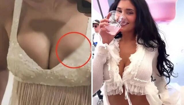 Milyonlarca hayranı bu sorunun cevabını arıyor: Kylie Jenner’ın silikonu mu patladı?
