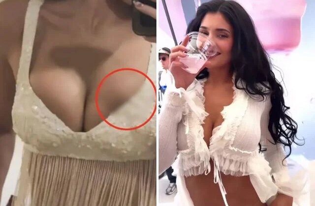 Milyonlarca hayranı bu sorunun cevabını arıyor: Kylie Jenner’ın silikonu mu patladı?