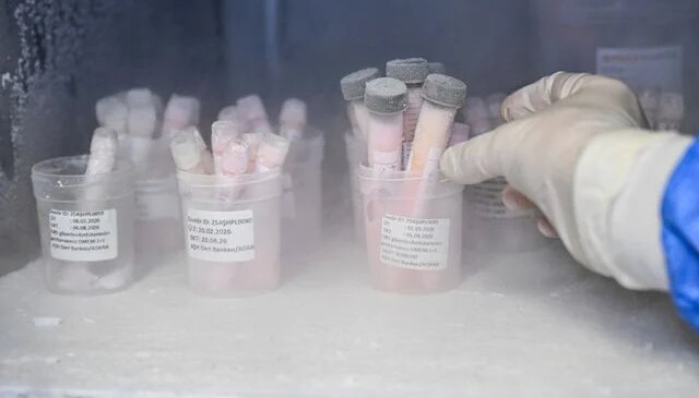 Türkiye’nin tek deri bankası ve doku laboratuvarına bağışlar artıyor