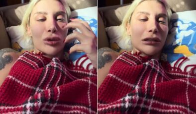 Ünlü isimlere operasyon sonrası İrem Derici’den tepki