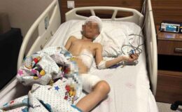 Van’daki köpek dehşetinde kan donduran detaylar