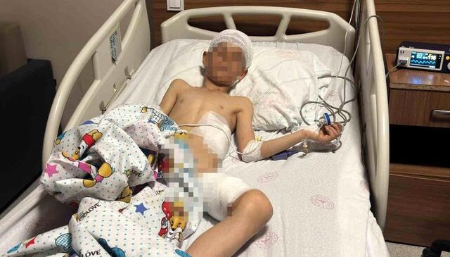 Van’daki köpek dehşetinde kan donduran detaylar