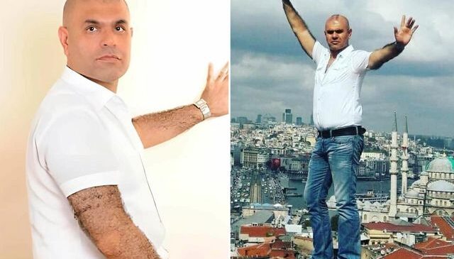 Ajdar, “50 milyon euro istiyorum” dediği programa katıldı