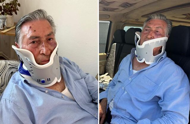 Tur şoförü, VIP transfer hizmeti verdiği Litvanyalı boksör tarafından hastanelik edildi