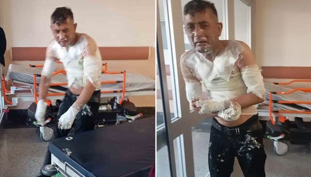 Engelli vatandaşı benzin döküp yakan vicdansıza verilen ceza belli oldu