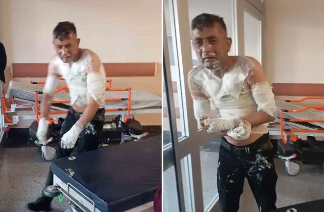 Engelli vatandaşı benzin döküp yakan vicdansıza verilen ceza belli oldu