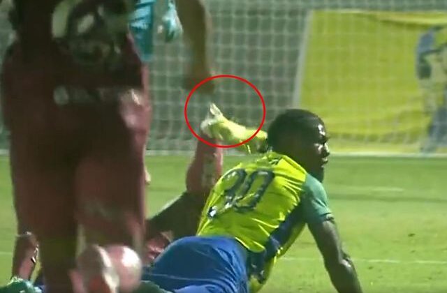 Genç futbolcunun bacağı kırıldı! O anlar kamerada