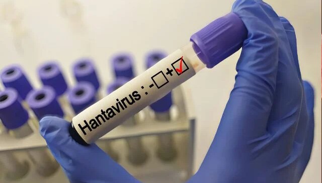 Hantavirüs grip gibi başlıyor! Bu belirtiler varsa aman dikkat