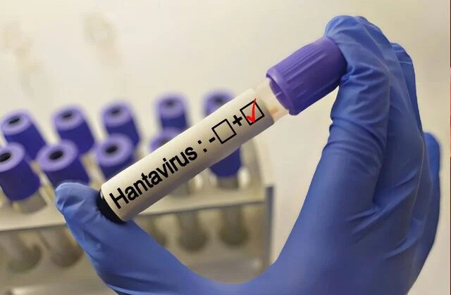 Hantavirüs grip gibi başlıyor! Bu belirtiler varsa aman dikkat