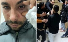 Hastasına yumruk atan doktora dava