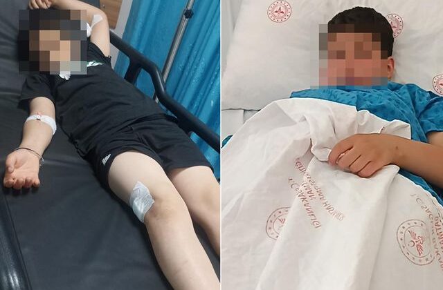 Çocukların elleri tetikte! 9 yaşında parkta vuruldu