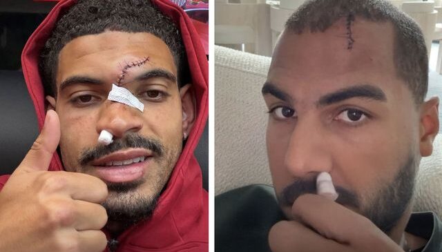 Kafa kafaya çarpışan Morgan Gibbs-White ve Robert Sanchez’in yüzünün son durumu korkuttu