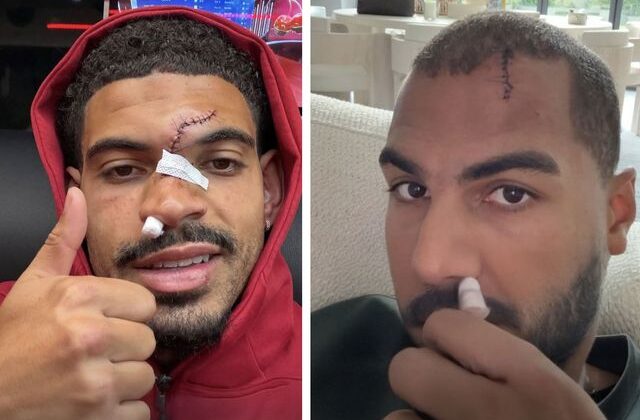 Kafa kafaya çarpışan Morgan Gibbs-White ve Robert Sanchez’in yüzünün son durumu korkuttu