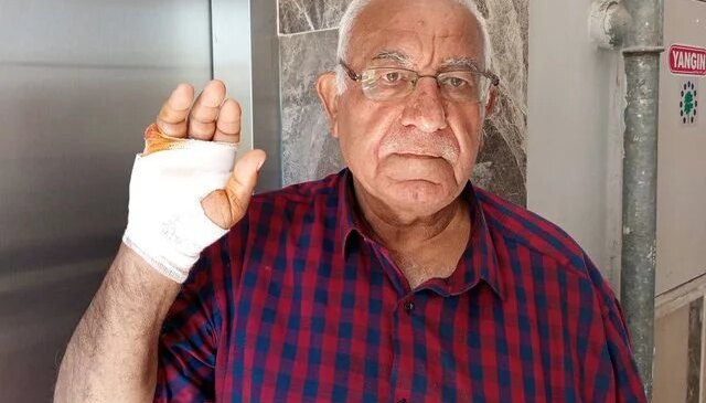Komşusunun ısırdığı parmağı ampute edildi