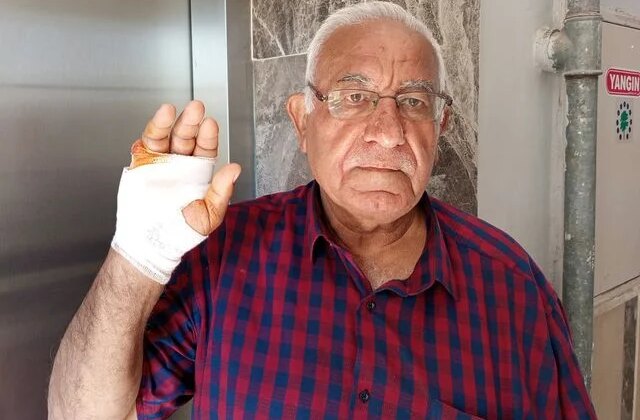 Komşusunun ısırdığı parmağı ampute edildi