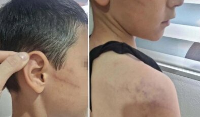 Babasının, öğretmeninden harçlık istedi diye darbettiği çocuk devlet korumasına alındı