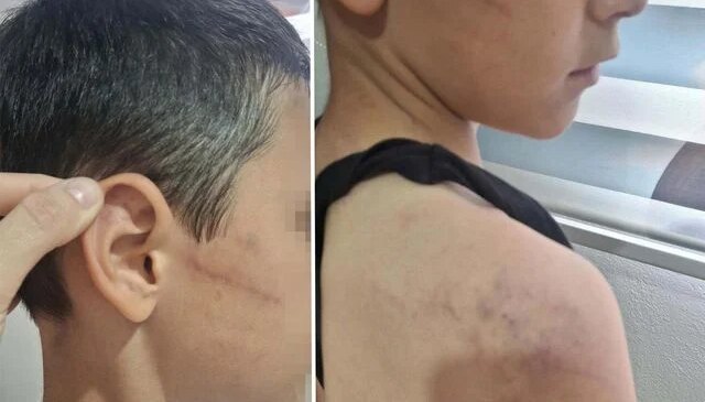 Babasının, öğretmeninden harçlık istedi diye darbettiği çocuk devlet korumasına alındı