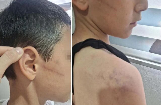 Babasının, öğretmeninden harçlık istedi diye darbettiği çocuk devlet korumasına alındı
