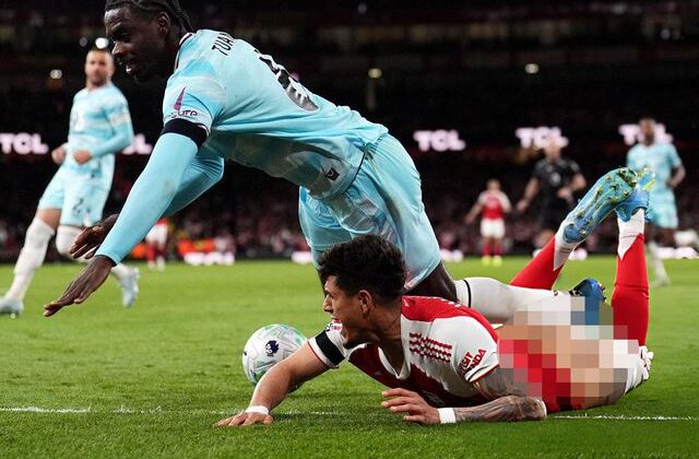 Yıldız futbolcuya şok! Kalçasını bütün dünya gördü