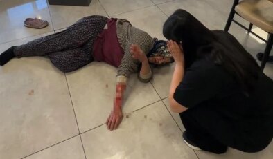 Saldırgan köpek kadının kolunu kopardı