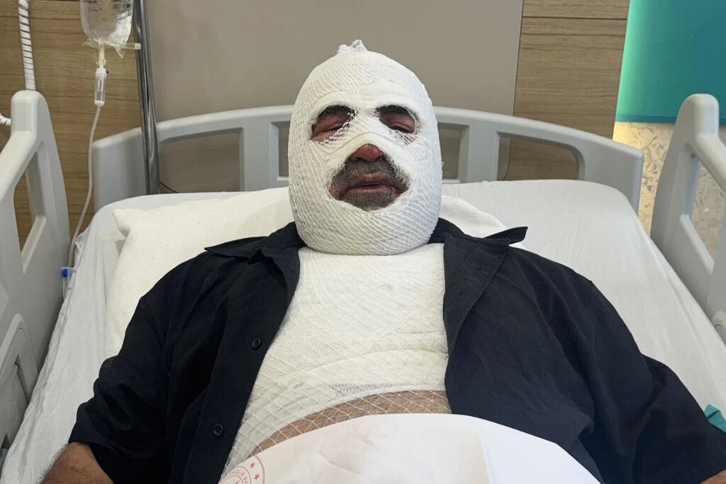 Erzurum'da hararet yapan aracı kontrol eden sürücü ağır yaralandı